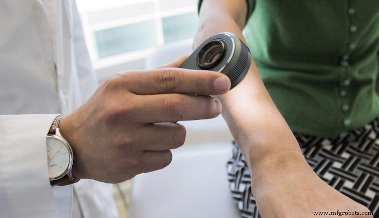 IA Supera Dermatologistas Experientes na Precisão de Detecção de Câncer de Pele